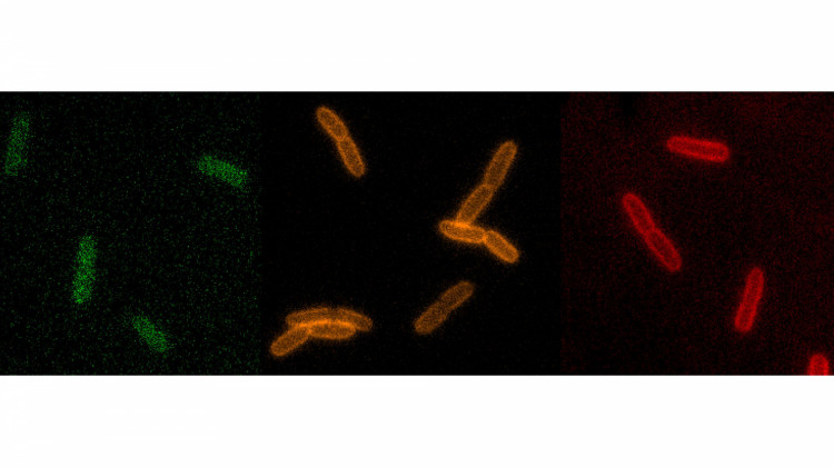 Chemical Probes Could Point To New Antibiotics