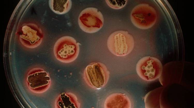 Scientists Turn To The Crowd In Quest For New Antibiotics