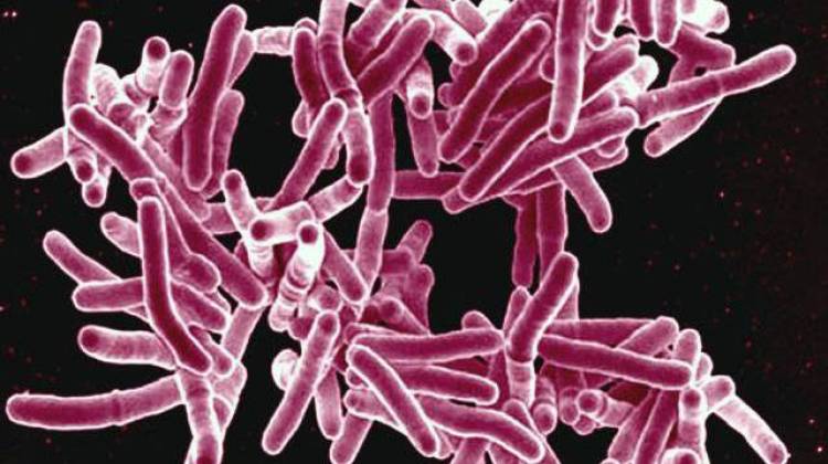 IUPUI Student Diagnosed With Tuberculosis