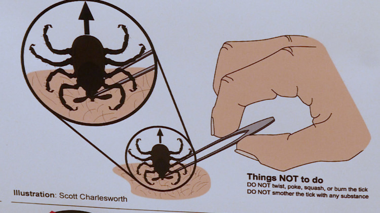 A poster at Purdue University shows how to correctly remove a tick.  - Rebecca Thiele/IPB News