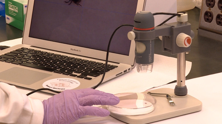 Is there an outbreak of Lyme disease this year? No, but tick diseases are on the rise.