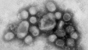 Flu Likely Passed To Fair Visitor From Pig, Officials Say