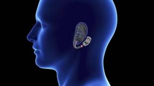 New Electric Device Guides Patients Through Crucial Withdrawal Period