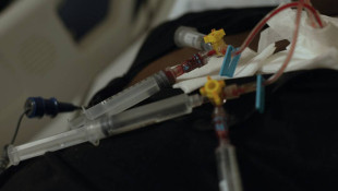 Sickle cell experts worry as CDC's Division of Blood Disorders staff put on leave