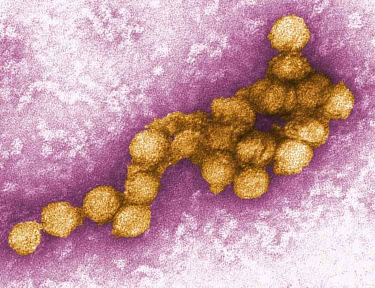 State Health Officials Announce West Nile Virus Death