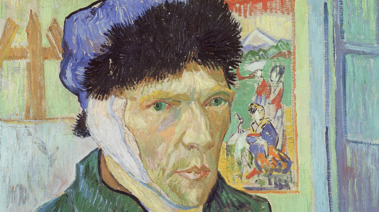 Van Gogh’s Ear